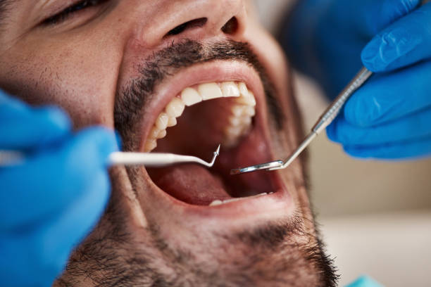 Best Emergency Dentist for Knocked-Out Tooth in La Ada Flintridge, CA